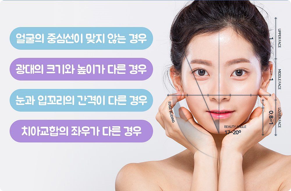 안면비대칭 자가진단: 얼굴 중심선, 광대 크기와 높이, 눈과 입꼬리 간격, 치아 교합의 좌우